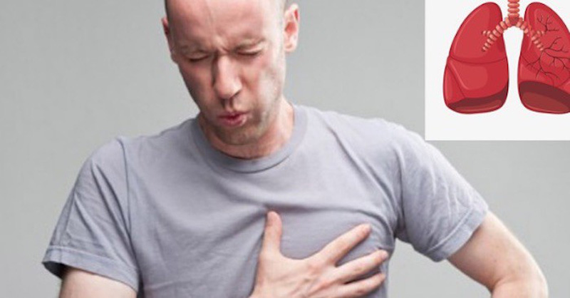 Những triệu chứng điển hình của tràn dịch màng phổi do lao